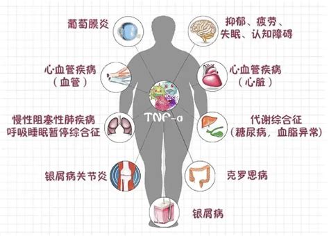 多病|老年人多病共存名词和定义专家共识(2022)